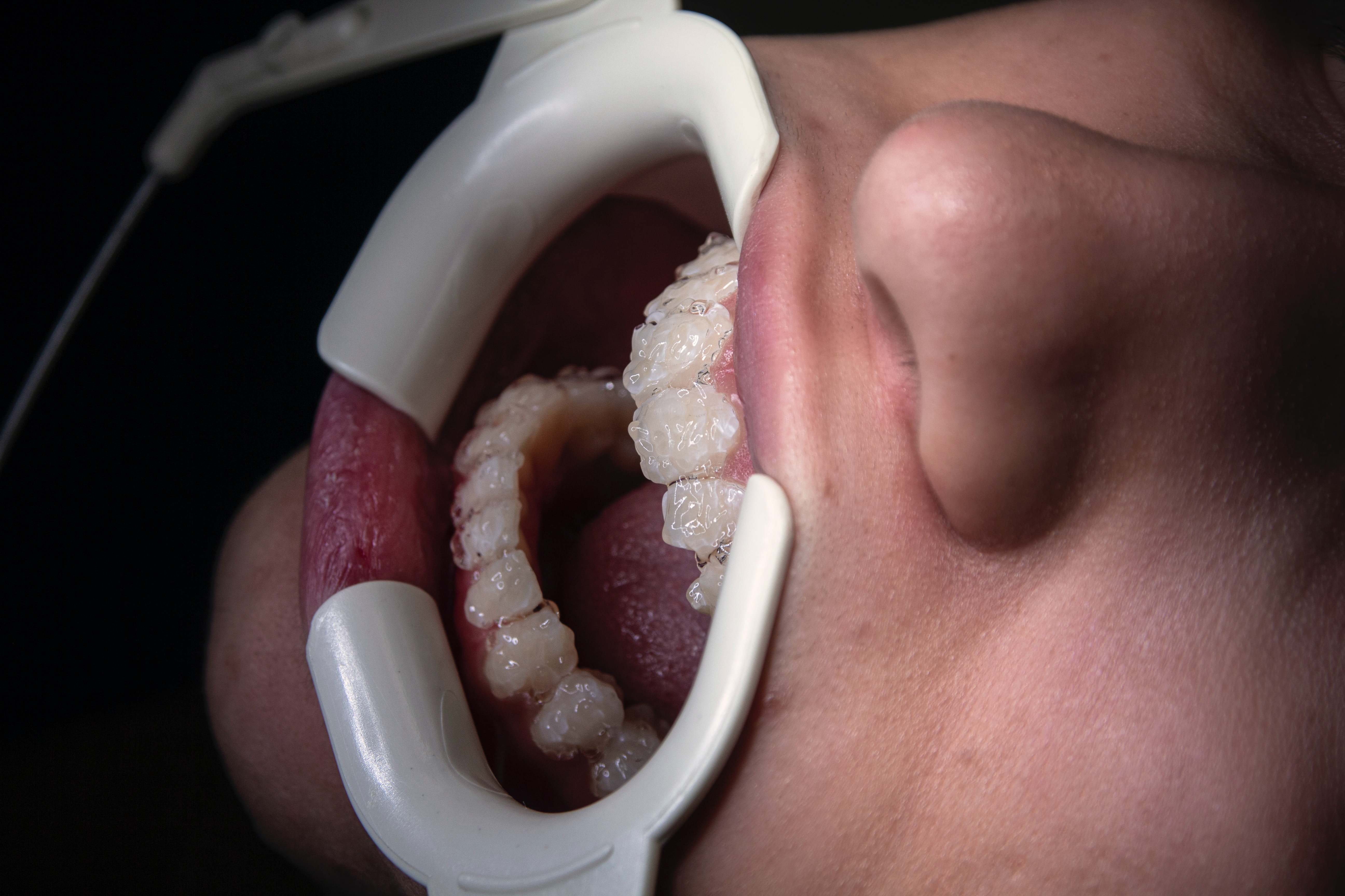 Conservative Dentistry& Endodontics